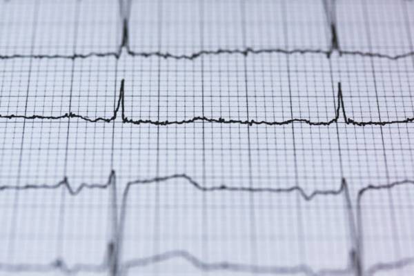 Comment savoir si vous faites une crise cardiaque ?